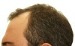 Hair Treatment