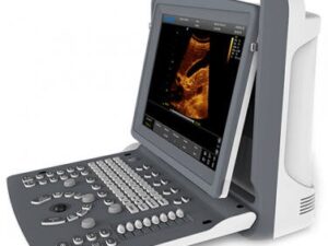 Chison ECO 3 Color Ultrasound Machine